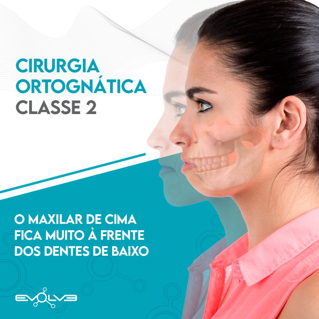 Evolve Implantes Cirurgicos